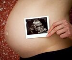 Abtreibungen: Ärzte sollen Geschlecht von Föten geheim halte